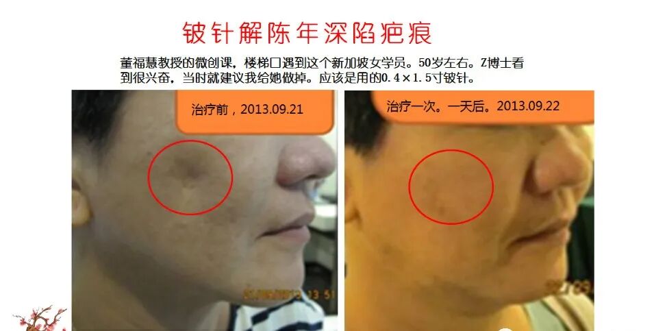 %title插图%num 图片