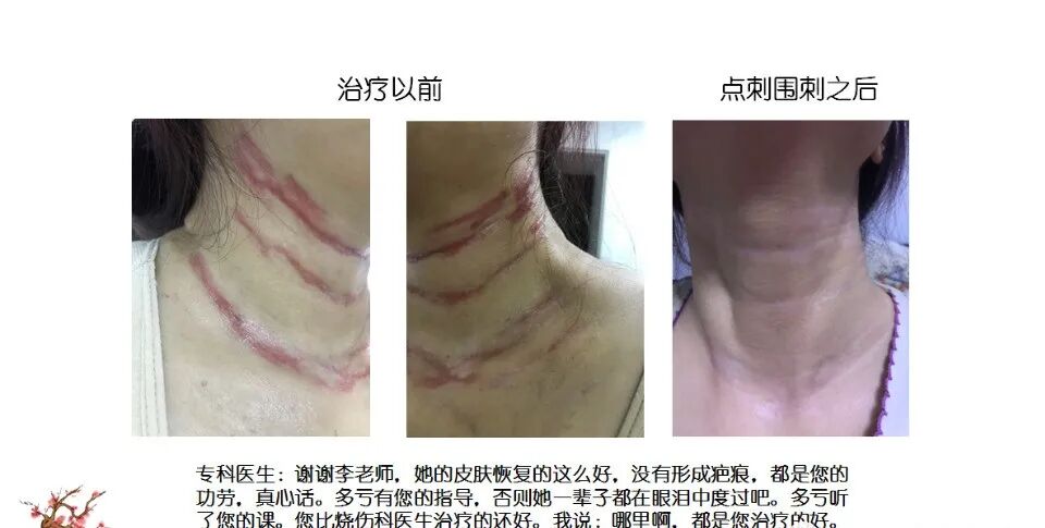 %title插图%num 图片