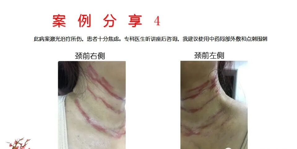 %title插图%num 图片