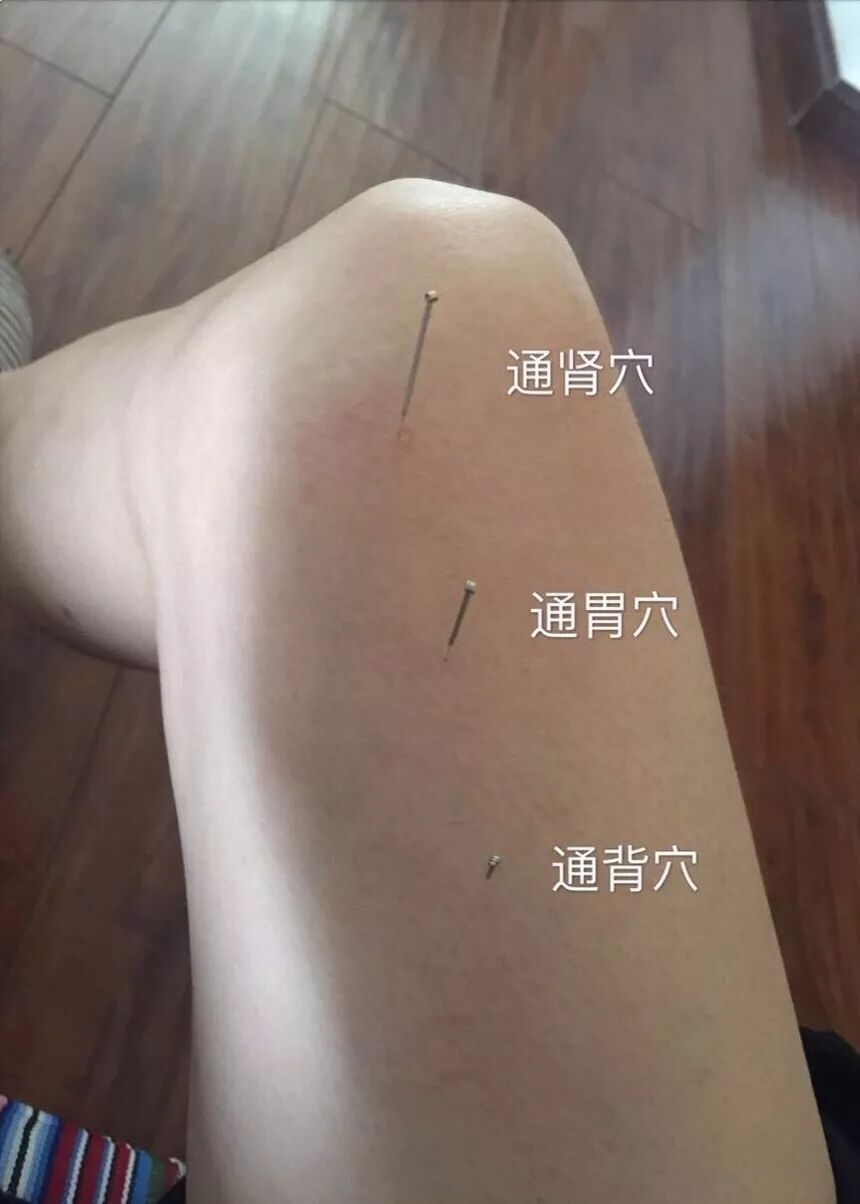 通肾胃背.jpg